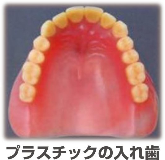 プラスチックの入れ歯